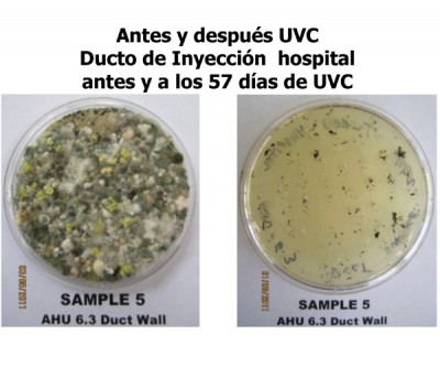 Antes y Después UVC - Ducto de Inyección Hospital